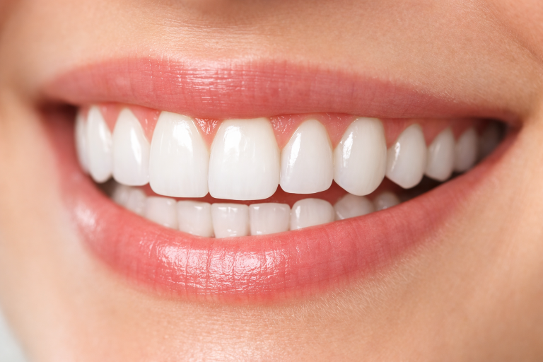 Woman's smile with white teeth Gum Health